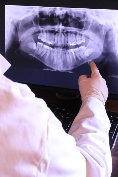 Best Emergency Treatment for Dental Infections or Abscesses in Oakhurst, NJ