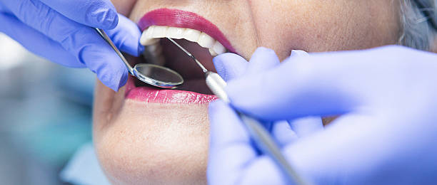 Best Emergency Treatment for Dental Infections or Abscesses in Oakhurst, NJ